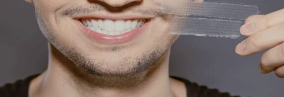 Oxford White Teeth Whitening Strips: A Complete Guide to Achieving a Brighter Smile