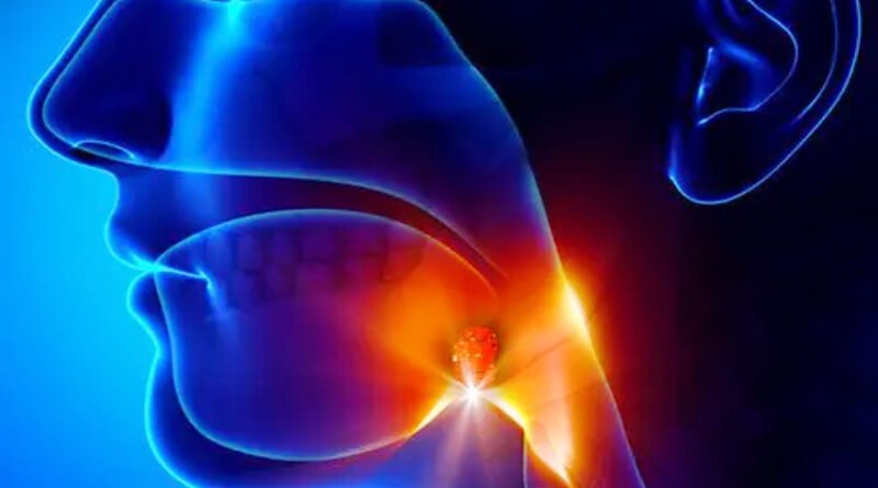 Understanding Adenoiditis: Causes, Symptoms, and Analysis Options